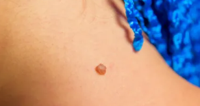 Memutus Siklus Hidup Mikroba: Strategi Sanitasi untuk Kulit Sempurna